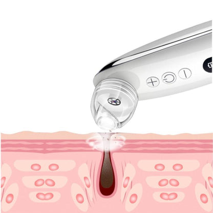 HexoSkin™ Visuell pormaskborttagare med HD-kamera